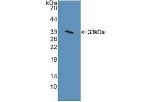 Detection of Recombinant ITGa2, Human using Polyclonal Antibody to Integrin Alpha 2 (ITGa2) (ITGA2 Antikörper  (AA 74-277))