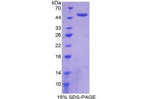 SDS-PAGE analysis of Human Interferon alpha 21 Protein. (IFNA21 Protein)