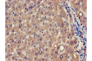 Immunohistochemistry of paraffin-embedded human liver tissue using ABIN7175353 at dilution of 1:100 (VPS39 Antikörper  (AA 263-490))
