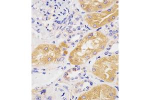 (ABIN1944892 and ABIN2838534) staining H in human kidney tissue sections by Immunohistochemistry (IHC-P - raformaldehyde-fixed, raffin-embedded sections). (Phenylalanine Hydroxylase Antikörper  (AA 127-161))