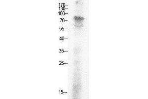 Western Blotting (WB) image for anti-Ubiquitin (Ub) (acLys29) antibody (ABIN3181497)
