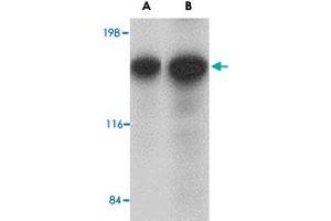 Western blot analysis of CADPS in rat brain tissue lysate with CADPS polyclonal antibody  at (A) 0. (CADPS Antikörper  (N-Term))