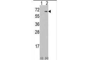 Western blot analysis of CKK1 (arrow) using rabbit polyclonal CKK1 Antibody (N-term) (ABIN392189 and ABIN2841895). (CAMKK1 Antikörper  (N-Term))