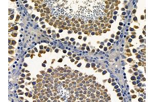 ABIN6264551 and ABIN6272407 at 1/100 staining rat testis tissue by IHC-P. (RAB11FIP4 Antikörper  (Internal Region))