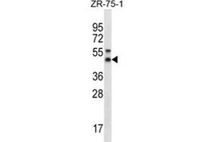 Western Blotting (WB) image for anti-Syntaxin 5 (STX5) antibody (ABIN2996624)