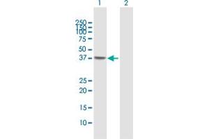 Western Blot analysis of NSDHL expression in transfected 293T cell line by NSDHL MaxPab polyclonal antibody. (NSDHL Antikörper  (AA 1-373))