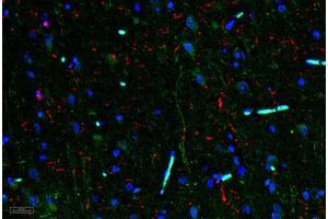 Image no. 3 for anti-Interleukin 11 (IL11) antibody (ABIN465144) (IL-11 Antikörper)