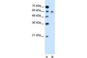 Western Blotting (WB) image for anti-Tyrosinase (TYR) antibody (ABIN2462800) (TYR Antikörper)