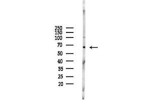 anti-Prolactin Receptor (PRLR) (N-Term) antibody