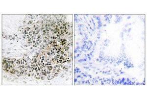 Immunohistochemistry (IHC) image for anti-Trichorhinophalangeal Syndrome I (TRPS1) (N-Term) antibody (ABIN1850056)