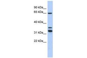 Image no. 1 for anti-S100P Binding Protein (S100PBP) (C-Term) antibody (ABIN6744009) (S100PBP Antikörper  (C-Term))
