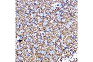 Immunohistochemistry (IHC) image for anti-Synaptosomal-Associated Protein, 25kDa (SNAP25) (AA 1-206) antibody (ABIN3021232)