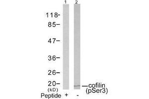 Western blot analysis of extracts from COLO205 cells using cofilin(Phospho-Ser3) Antibody(Lane 2) and the same antibody preincubated with blocking peptide(Lane1). (Cofilin Antikörper  (pSer3))