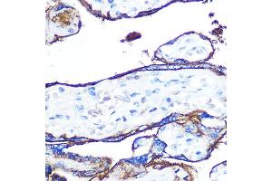 Immunohistochemistry of paraffin-embedded human placenta using CD55 Rabbit mAb (ABIN7266478) at dilution of 1:100 (40x lens). (CD55 Antikörper)
