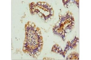 Immunohistochemistry of paraffin-embedded human small intestine tissue using ABIN7154739 at dilution of 1:100 (GNA15 Antikörper  (AA 1-374))