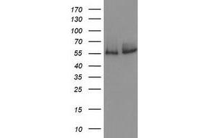 Catalase Antikörper