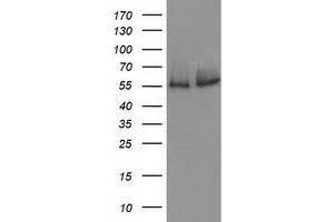 Western Blotting (WB) image for anti-Catalase (CAT) antibody (ABIN1497109)