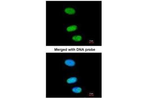 ICC/IF Image Immunofluorescence analysis of paraformaldehyde-fixed HeLa, using SOX13, antibody at 1:200 dilution. (SOX13 Antikörper)