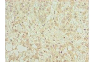 Immunohistochemistry of paraffin-embedded human adrenal gland tissue using ABIN7158923 at dilution of 1:100 (MFSD8 Antikörper  (AA 1-40))