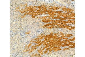 ABIN6260864 and ABIN6266508 at 1/100 staining Rat kidney tissue by IHC-P. (Claudin 2 Antikörper  (C-Term))