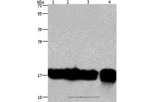Western blot analysis of A549 and K562 cell, Raji cell and human fetal intestine tissue, using IL17C Polyclonal Antibody at dilution of 1:300 (IL17C Antikörper)