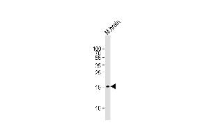 Western Blotting (WB) image for anti-GABA(A) Receptor-Associated Protein (GABARAP) antibody (ABIN4909795)