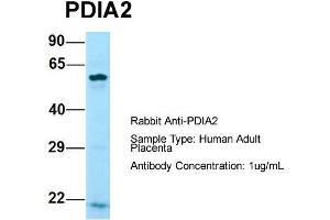 Host: Rabbit  Target Name: PDIA2  Sample Tissue: Human Adult Placenta  Antibody Dilution: 1. (PDIA2 Antikörper  (N-Term))
