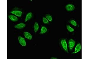 Immunofluorescence (IF) image for anti-Integrin beta 4 (ITGB4) (AA 1401-1533) antibody (ABIN7156486)