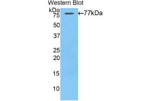 Western blot analysis of the recombinant protein. (AGT Antikörper  (AA 35-485))