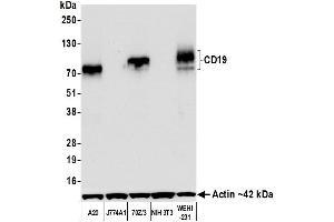 Western Blotting (WB) image for anti-CD19 Molecule (CD19) (AA 19-287) antibody (ABIN7455123)