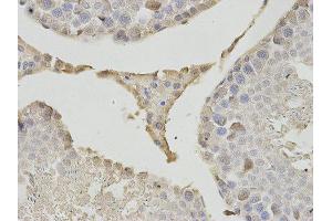 Immunohistochemistry (IHC) image for anti-Proteasome (Prosome, Macropain) Subunit, beta Type, 1 (PSMB1) antibody (ABIN1875399) (PSMB1 Antikörper)