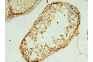 Immunohistochemistry of paraffin-embedded human testis tissue using ABIN7173289 at dilution of 1:100 (TMEM9 Antikörper  (AA 111-183))