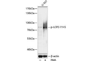 Western blot analysis of extracts of U937 cells, using Phospho-LCP2-Y145 antibody (ABIN7268318) at 1:1000 dilution.