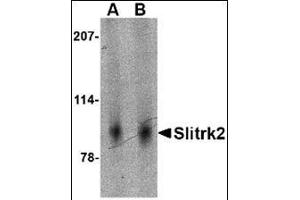Western blot analysis of Slitrk2 in mouse brain tissue lysate with this product at (A) 1 and (B) 2 μg/ml.