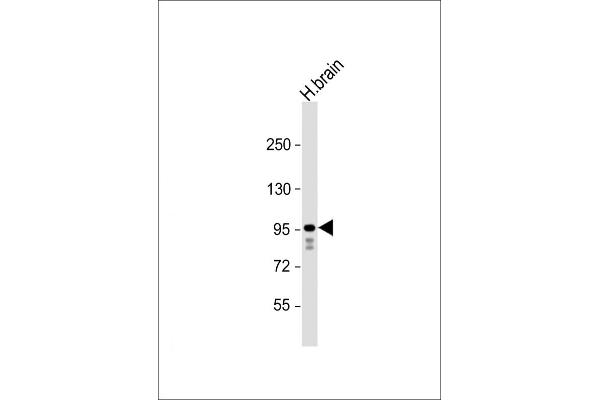 GRIA4 Antikörper  (AA 296-325)