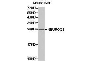 Western Blotting (WB) image for anti-Neurogenin 1 (NEUROG1) antibody (ABIN1873884) (Neurogenin 1 Antikörper)