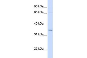WB Suggested Anti-TOLLIP Antibody Titration: 0. (TOLLIP Antikörper  (C-Term))