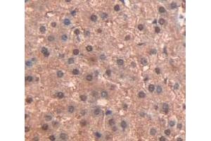 Figure. (PPARG Antikörper  (AA 157-274))