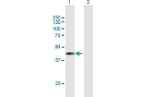 Western Blot analysis of BCKDK expression in transfected 293T cell line by BCKDK MaxPab polyclonal antibody. (BCKDK Antikörper  (AA 1-412))