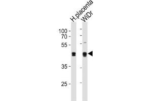 Western Blotting (WB) image for anti-SAP30 Binding Protein (SAP30BP) antibody (ABIN3004651) (SAP30BP Antikörper)
