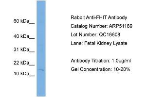WB Suggested Anti-FHIT  Antibody Titration: 0. (FHIT Antikörper  (Middle Region))