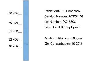 WB Suggested Anti-FHIT  Antibody Titration: 0.