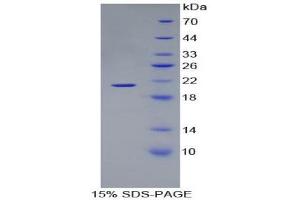 SDS-PAGE (SDS) image for Hemoglobin, alpha 1 (HBA1) (AA 1-142) protein (His tag) (ABIN2123834)