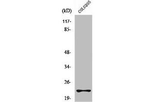 Western Blot analysis of A549 cells using Rho D Polyclonal Antibody (RHOD Antikörper  (Internal Region))