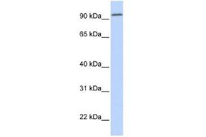DPP6 antibody used at 1 ug/ml to detect target protein. (DPP6 Antikörper  (Middle Region))