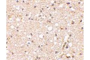 Immunohistochemical staining of human brain tissue using GRIK1 polyclonal antibody  at 2. (GRIK1 Antikörper  (Internal Region))