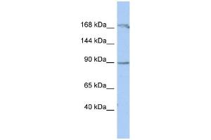 WB Suggested Anti-NARG1 Antibody Titration:  0. (NAA15 Antikörper  (Middle Region))