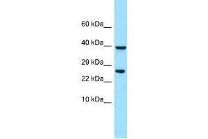 WB Suggested Anti-PDGFRL Antibody Titration: 1. (PDGFRL Antikörper  (N-Term))