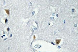 Immunohistochemistry (IHC) analyzes of p-Histone H2A. (H2AFX Antikörper  (pSer139))