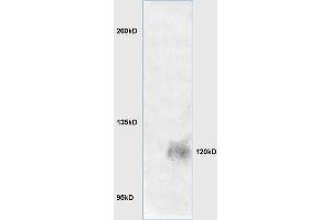 Lane 1: mouse brain lysates Lane 2: mouse embryo lysates probed with Anti LRIG1 Polyclonal Antibody, Unconjugated (ABIN735263) at 1:200 in 4 °C. (Lrig1 Antikörper  (AA 1001-1093))